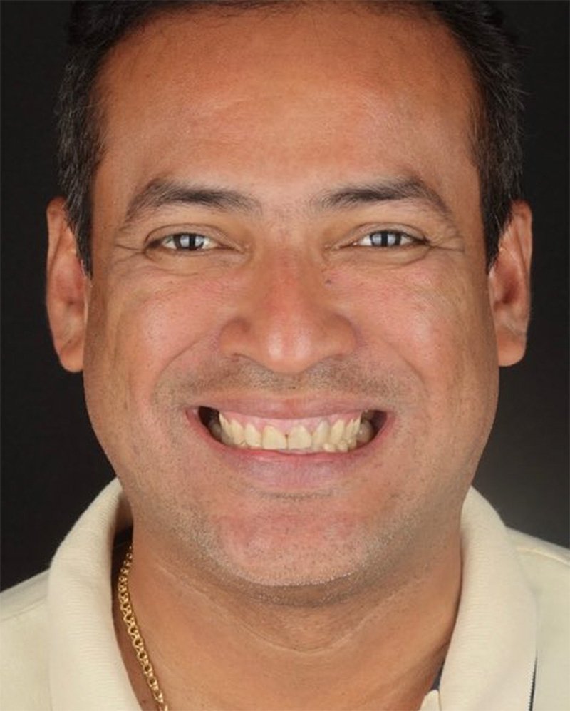 caso05-antes